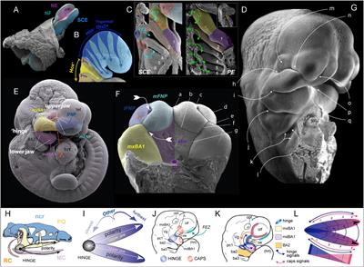 Programmed Cell Death Not as Sledgehammer but as Chisel: Apoptosis in Normal and Abnormal Craniofacial Patterning and Development